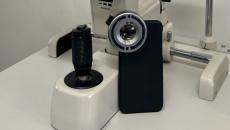 A prototype smartphone camera add-on that can detect UV damage to the eye