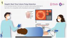 An animated visual of a gastrointestinal endoscopy procedure using DeepGI