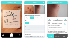 a mobile app for digital dermatology