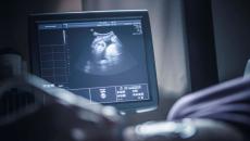 Sonogram monitor with person's hand 