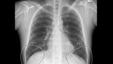 An X-ray scan from Vuno's Med-Chest X-Ray solution.