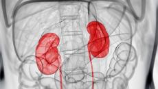 x-ray view of kidneys