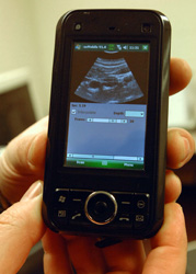 Ultrasound Mobile Phone