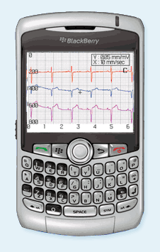 mVisum BlackBerry EKG