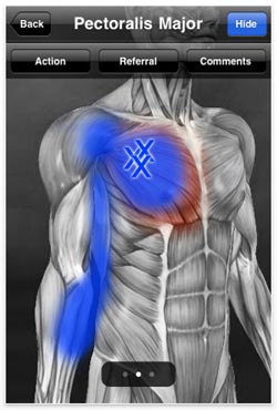 Medical App: Muscle Trigger Points