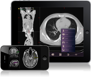 MIMViewer iPad medical apps