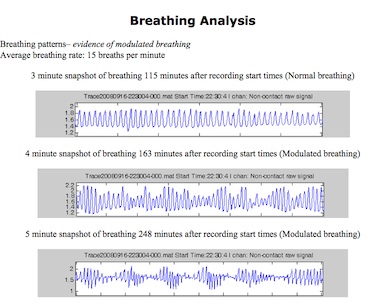 BiancaMed Sleep Report