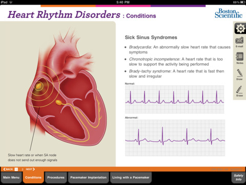 Boston Scientific CardioTeach