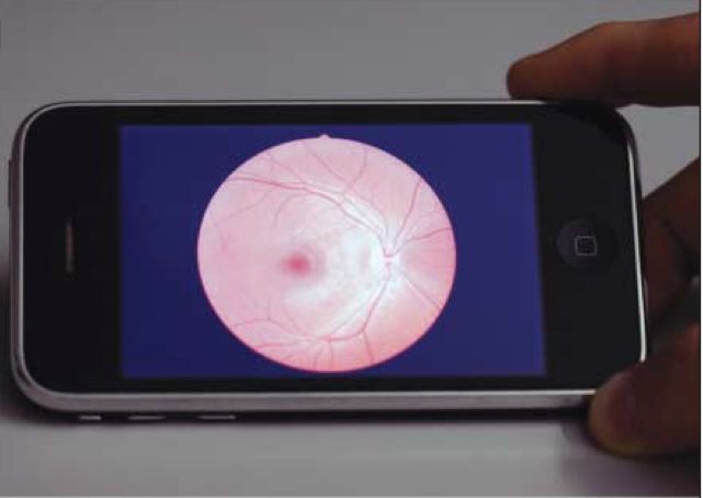 Using the iPhone for ophthalmology images