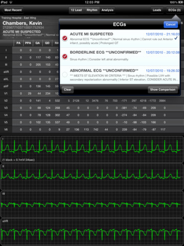 AirStrip Cardiology iPad