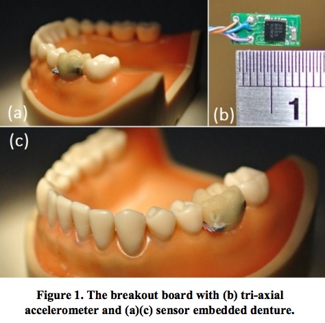 tooth sensor