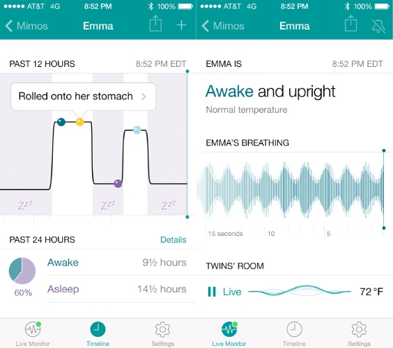 mimo smart baby monitor