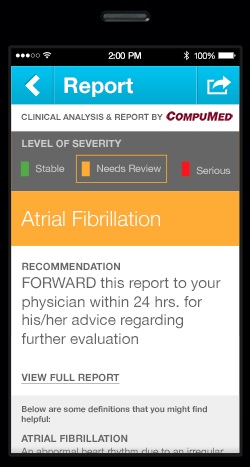 AliveCor Analysis