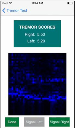 Alcohol withdrawal tremor app