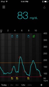 Medtronic's Guardian Mobile CGM app, yet to be released in the US.