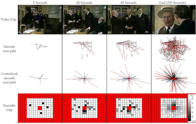 Glaucoma Study