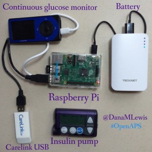 What-an-OpenAPS-looks-like-by-@DanaMLewis